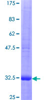12.5% SDS-PAGE Stained with Coomassie Blue.